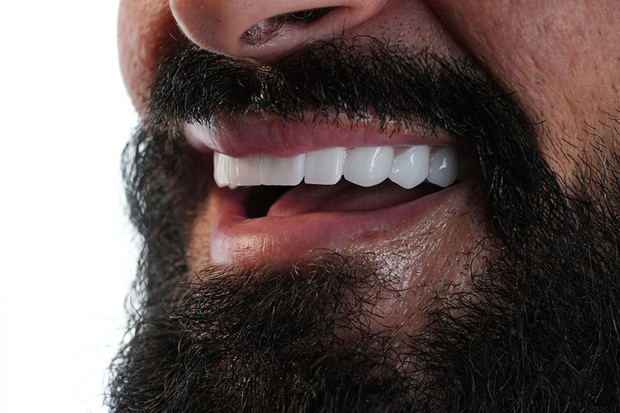 teeth whitening operations home bg