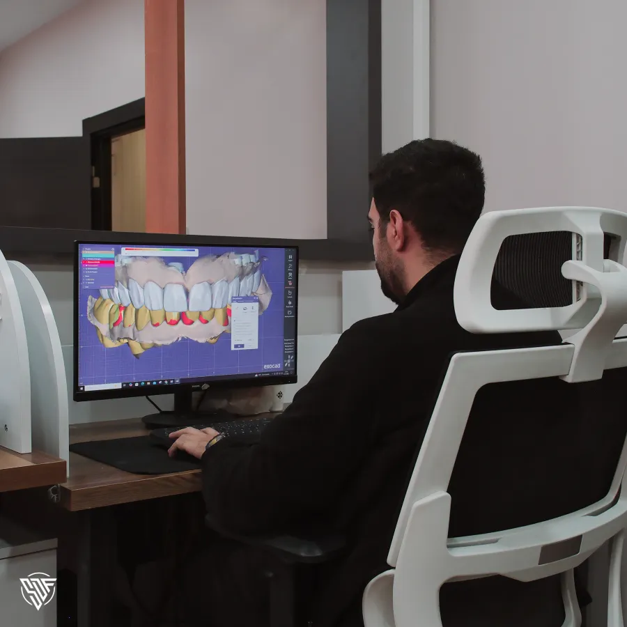 A case being designed in CAD