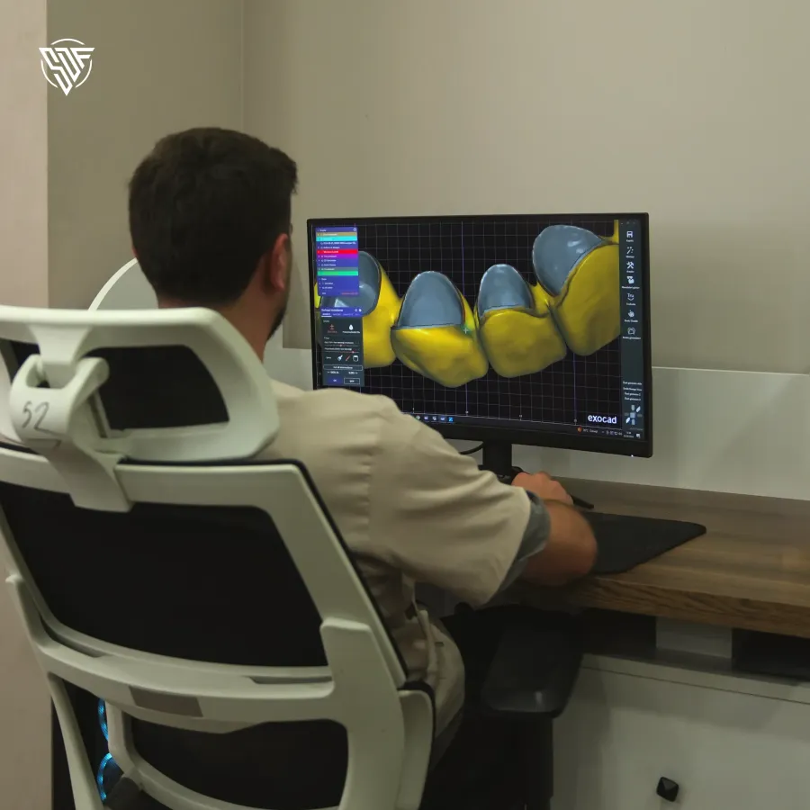 The anatomy shaped on screen