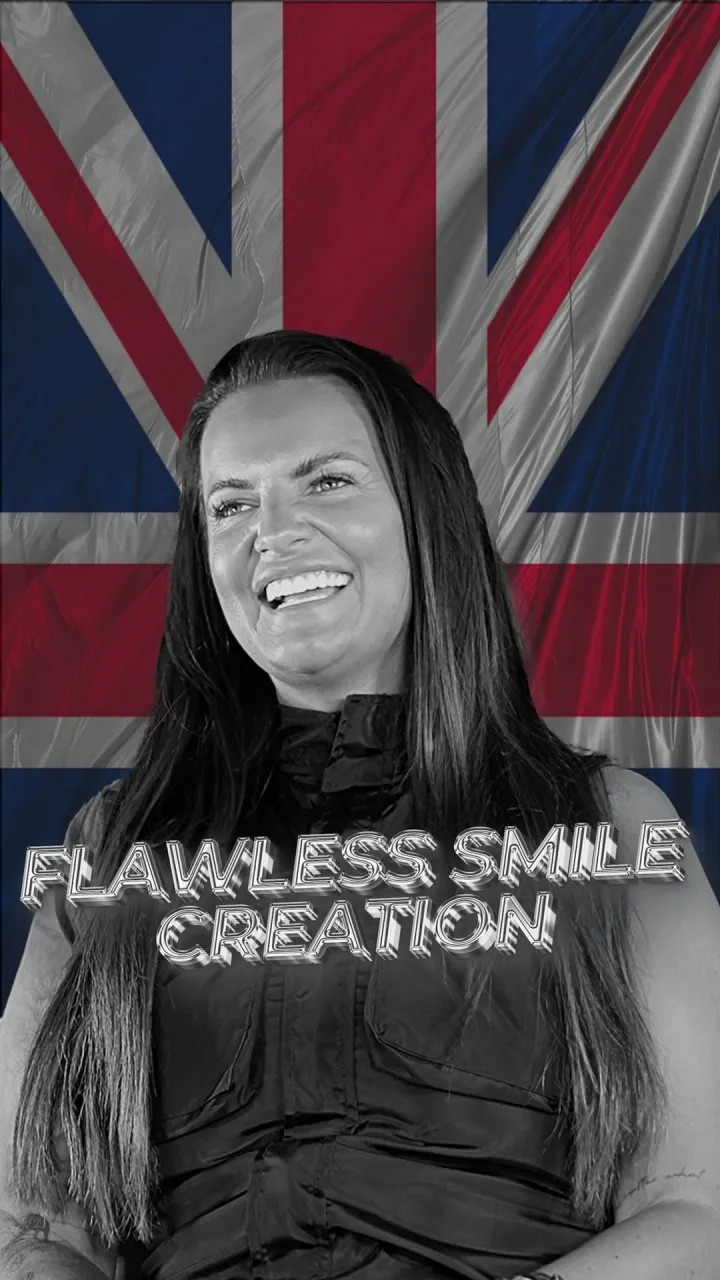 Flawless smile creation
