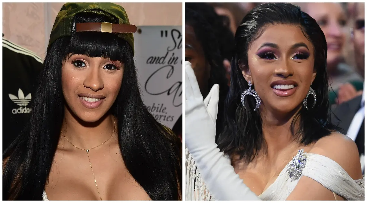 Cardi B Teeth Before and After