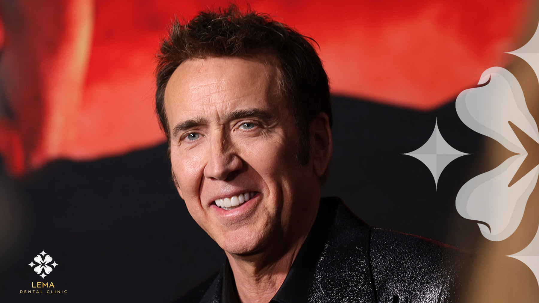 Nicolas Cage's teeth makeover before after