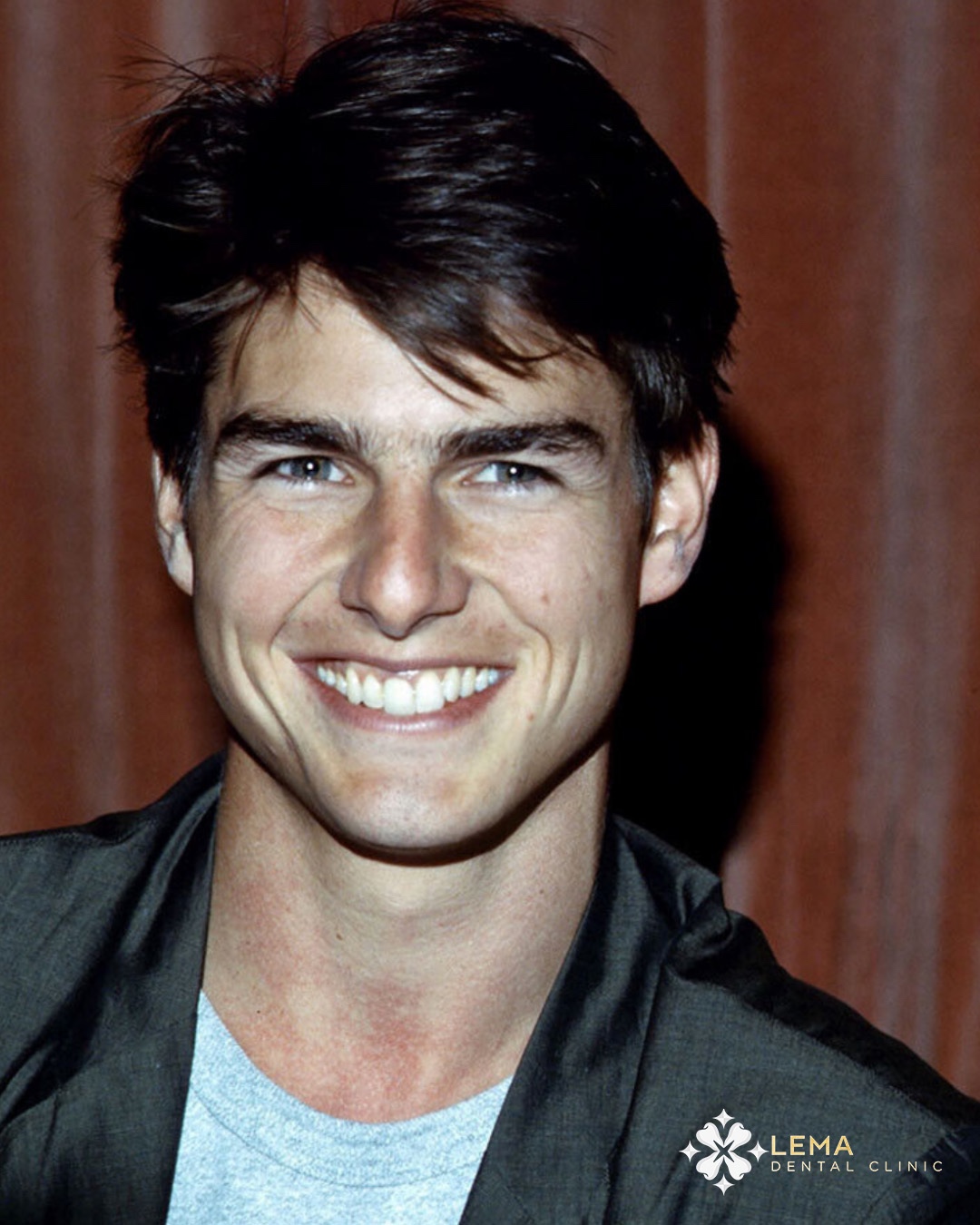Tom Cruise middle tooth