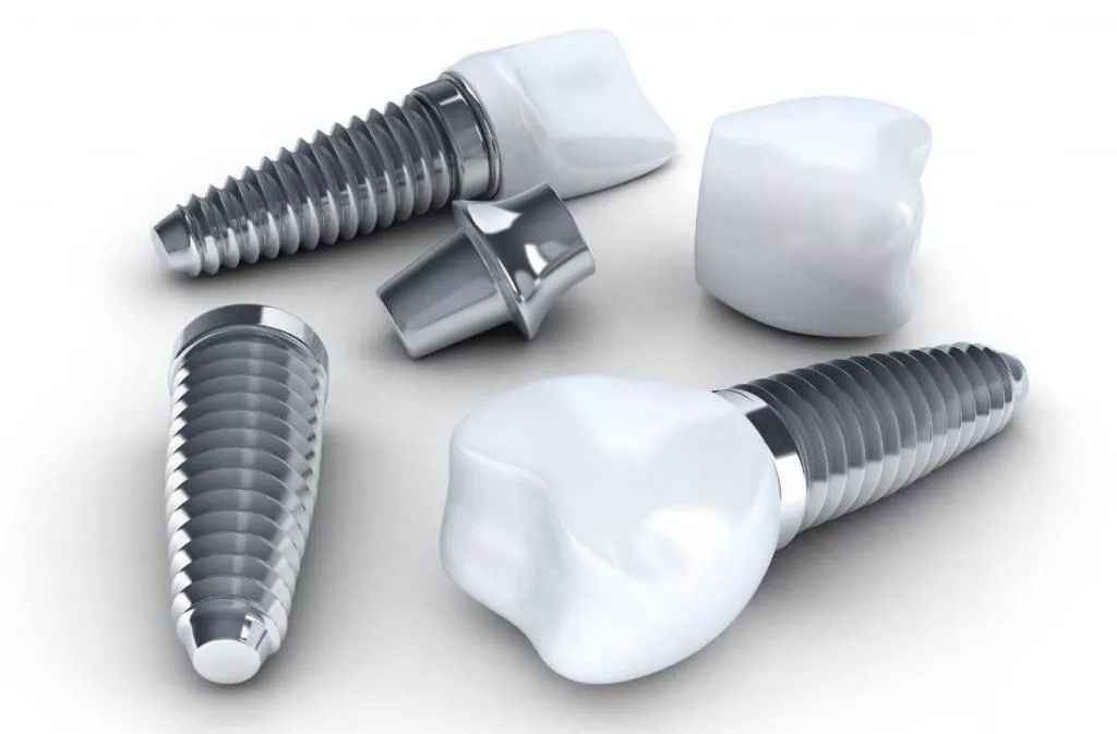 Qu’est-ce Que Le Traitement D’implant Dentaire?