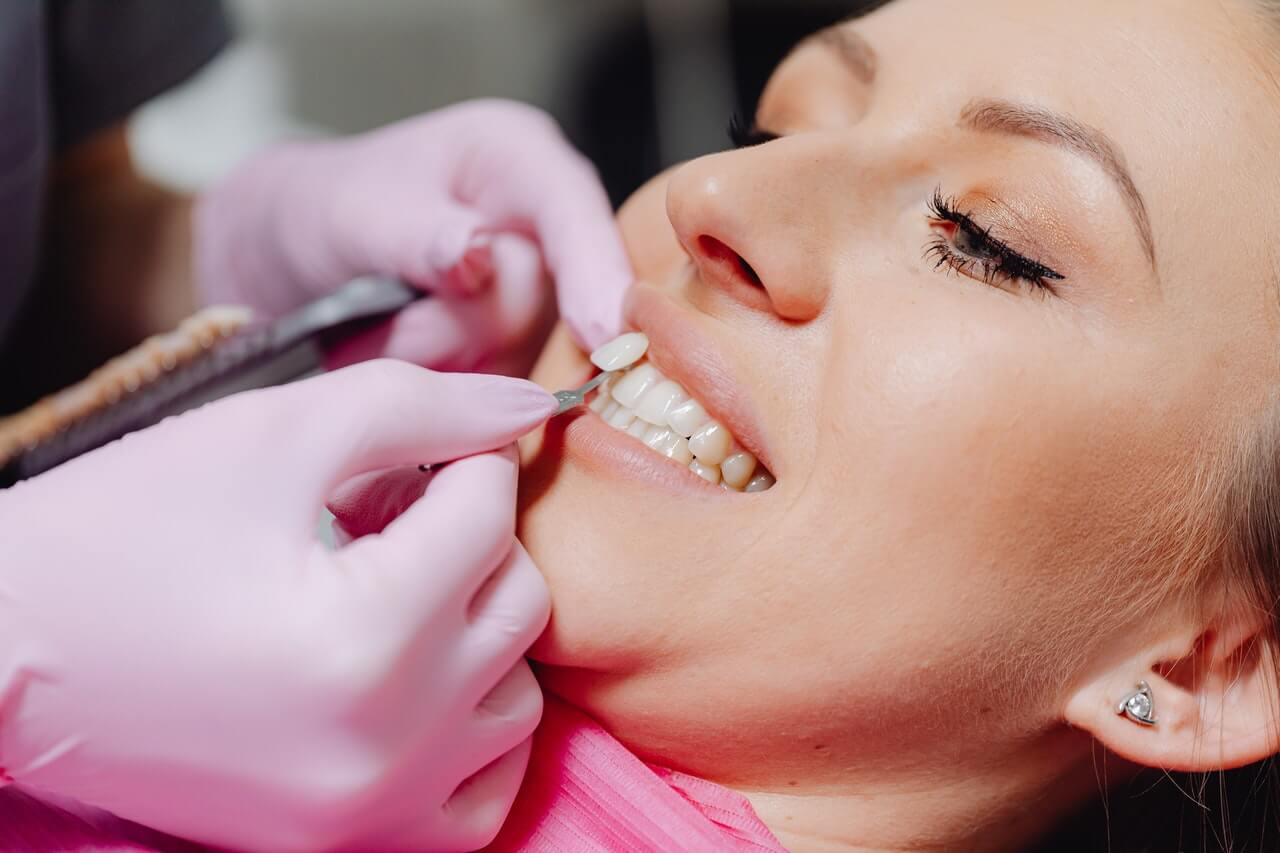 Composite Veneers Composite Veneers