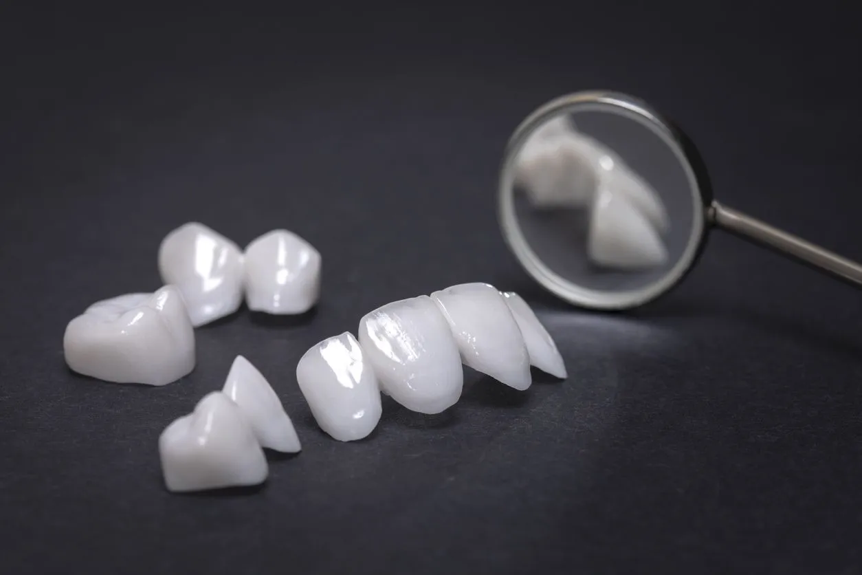 denal Veneer Types Dental Veneer Types