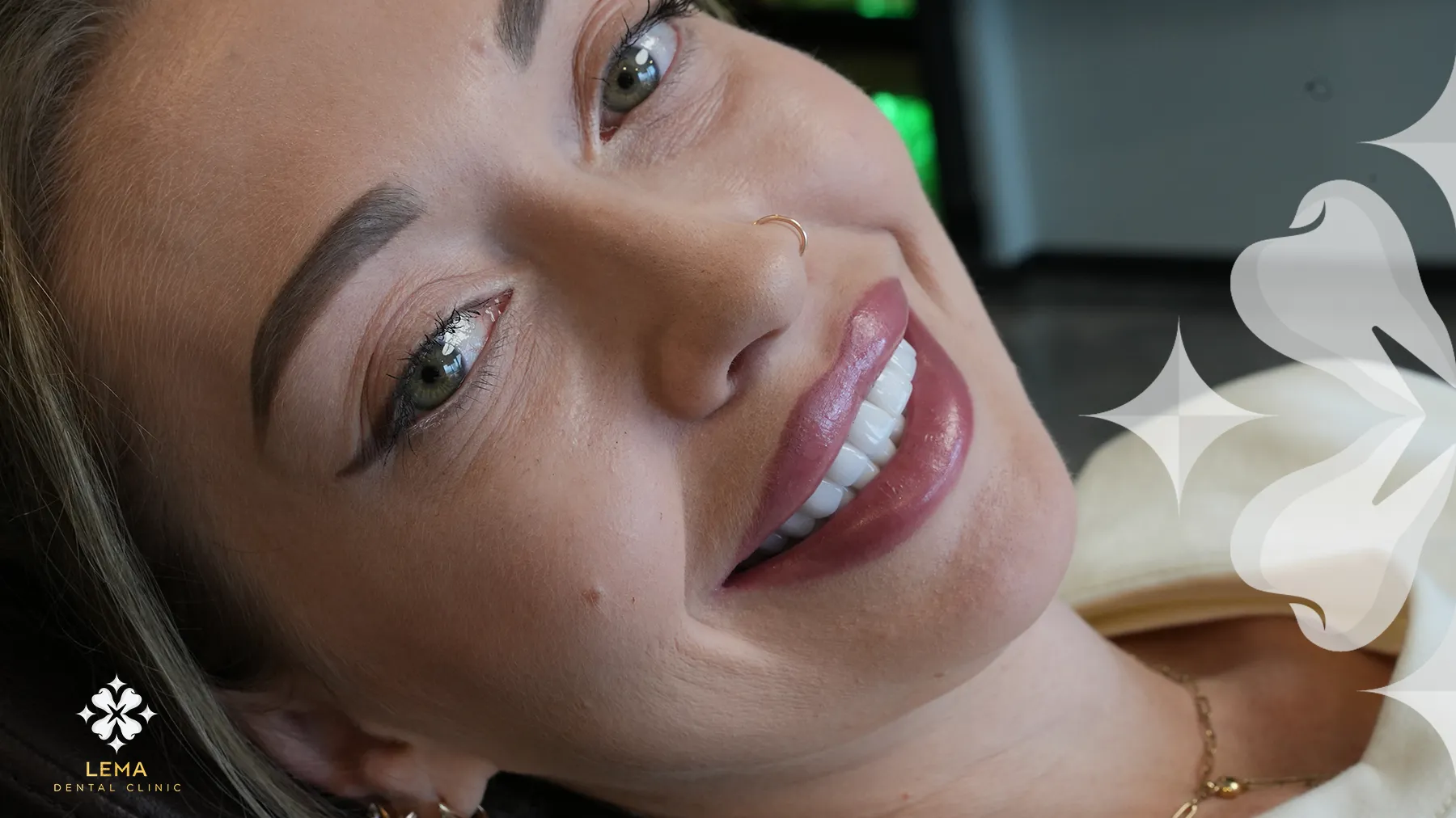Gummy Smiley Effective Treatment Methods for Confident Smile