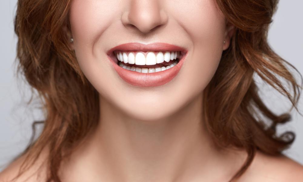 Perfect Smile