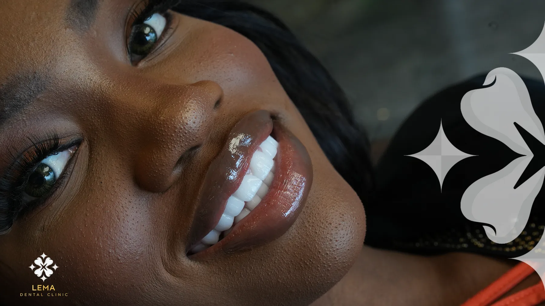 Turkey's Top 10 Reasons for Aesthetic Dental Treatment