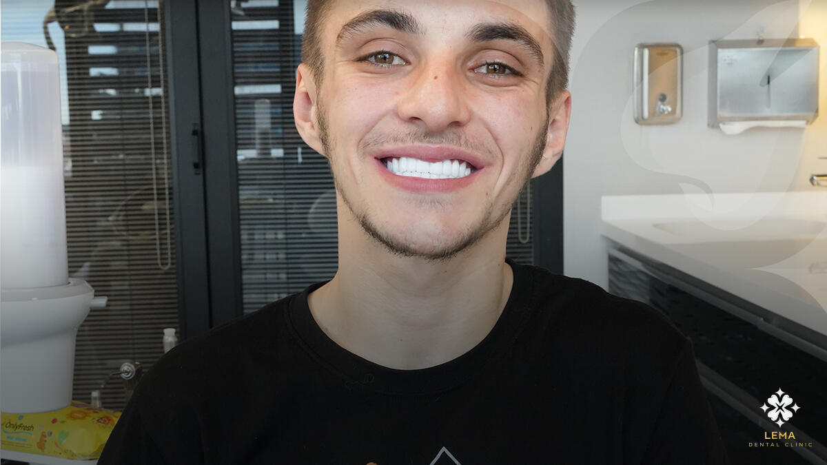 Could I Choose The Shape And Colors Of My Teeth Lema Clinic