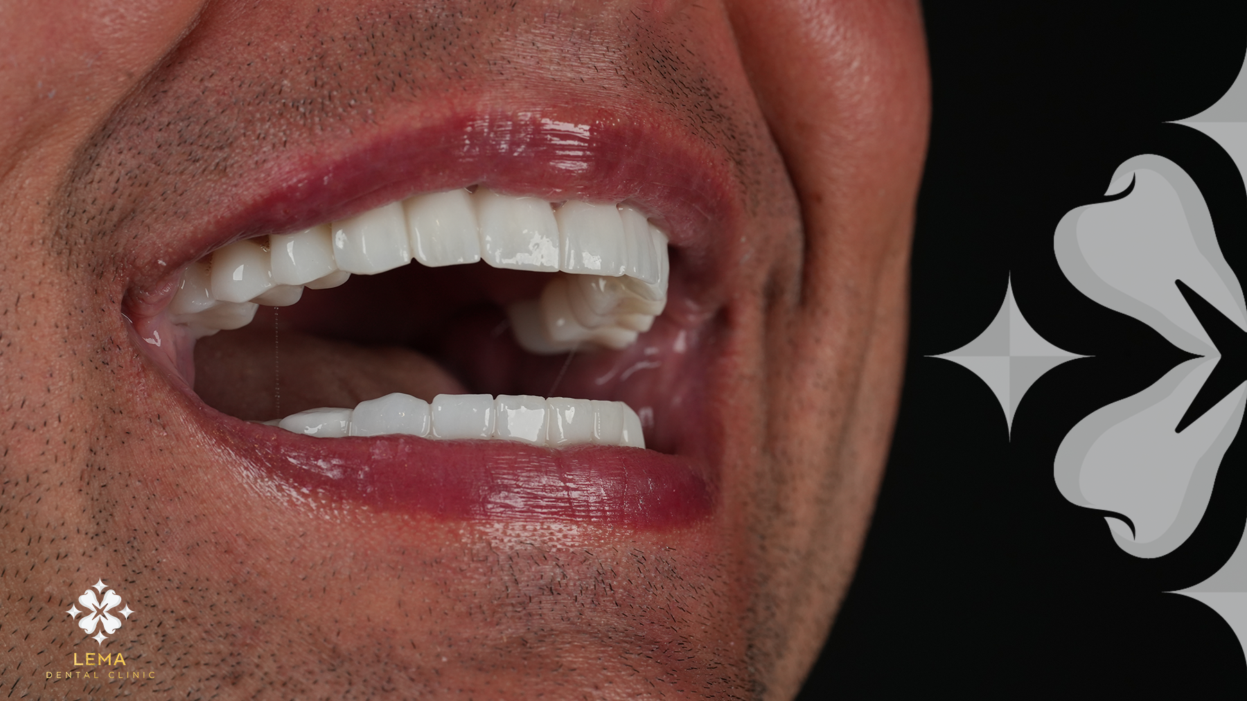 Could I Choose The Shape And Colors Of My Teeth