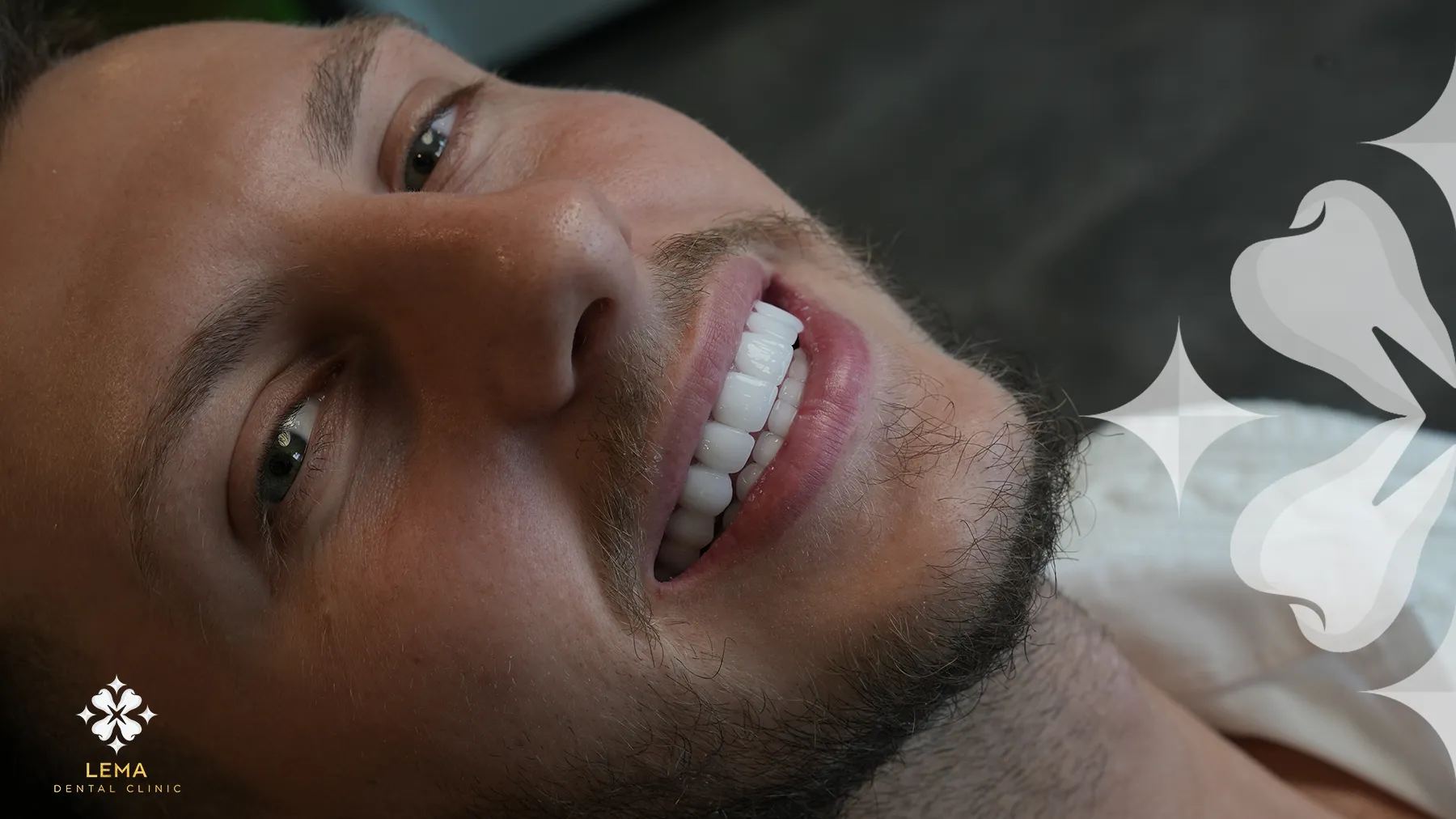 Is Teeth Whitening treatment Safe