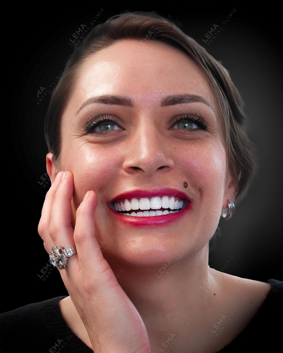  teeth whitening treatment