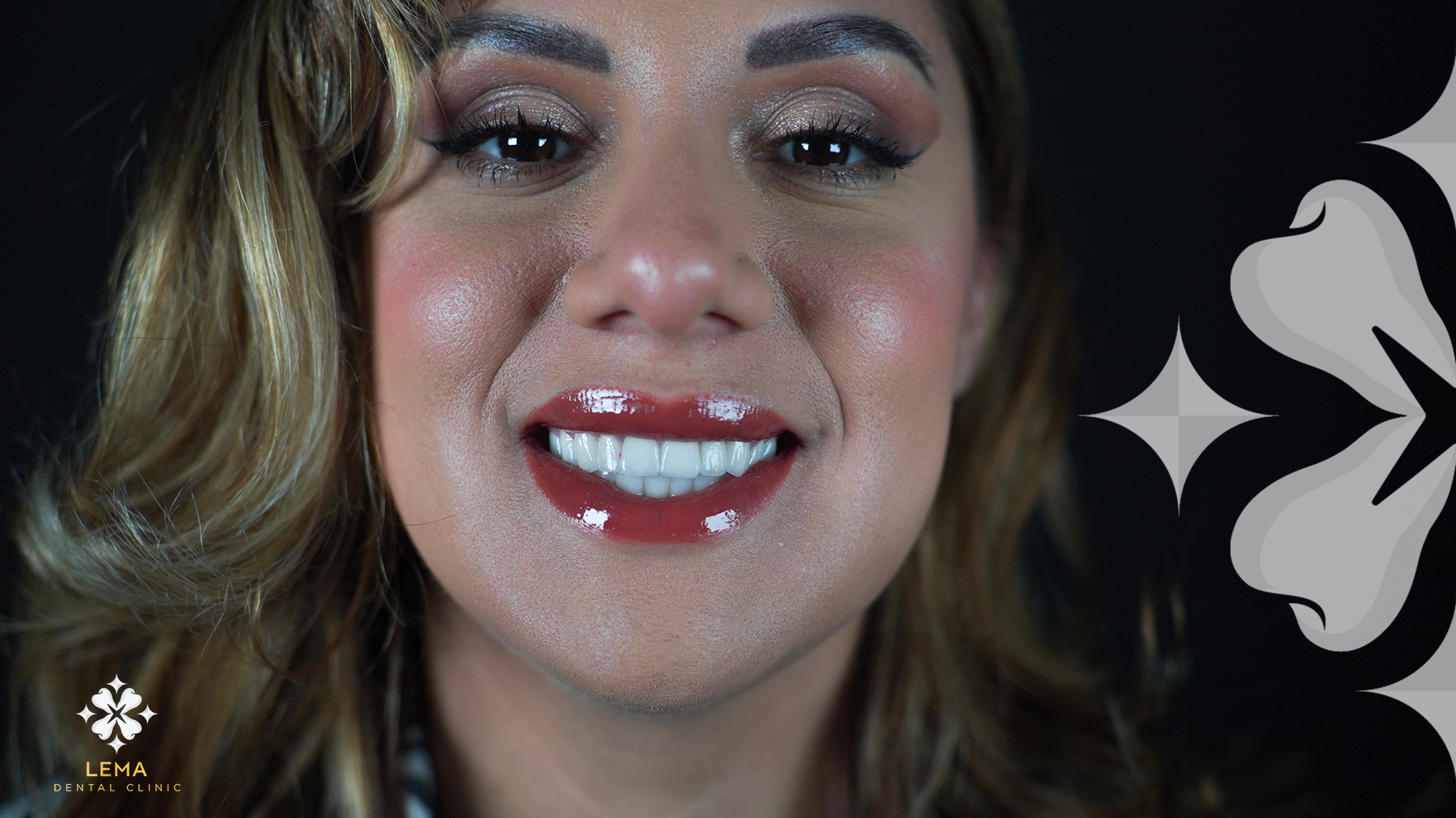 Ultimate Guide Top Hollywood Smile