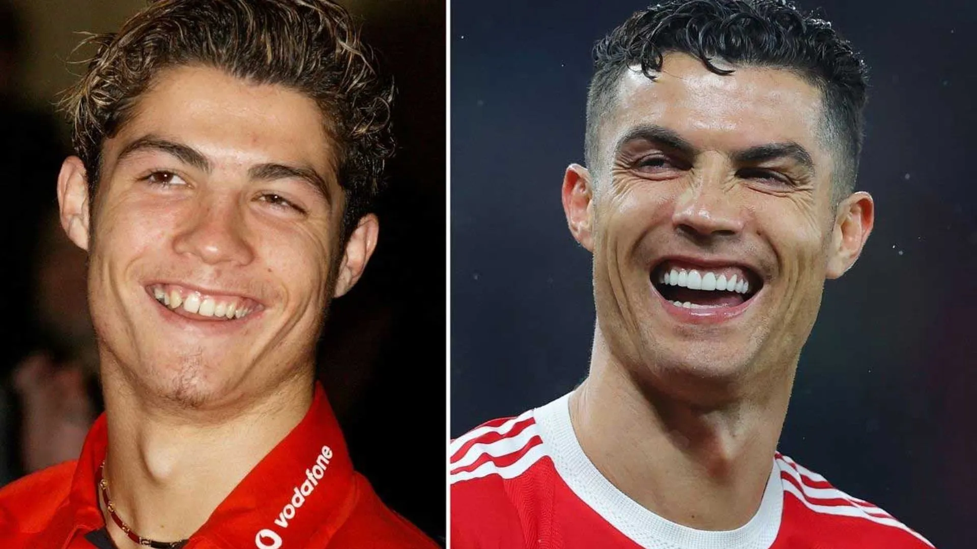Cristiano Ronaldo Dişleri Öncesi & Sonrası