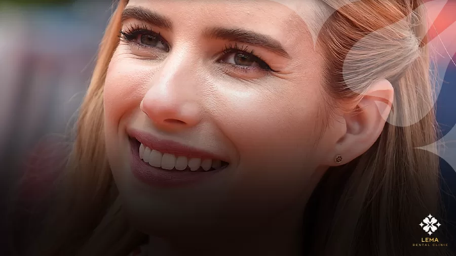 Emma Roberts gülüşü