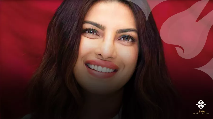 Priyanka Chopra's teeth