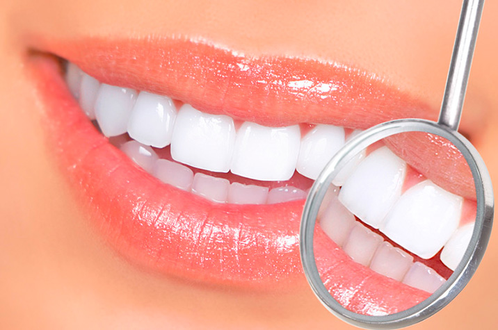 Implanturi Dentare