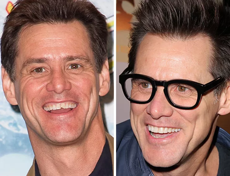 Jim Carrey Gülümseme Önce ve Sonra