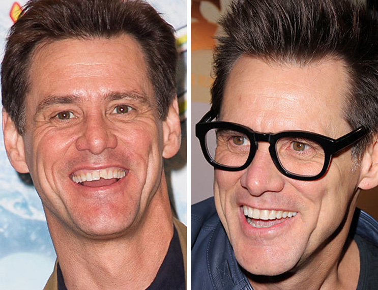 Jim carrey's smile before and after