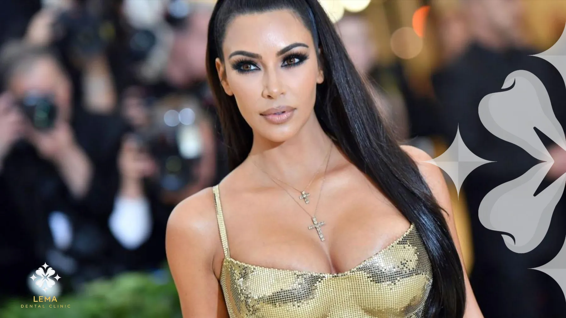 Zâmbetul De Milioane De Dolari Al Lui Kim Kardashian Călătoria Către Dinții Ei Perfecti