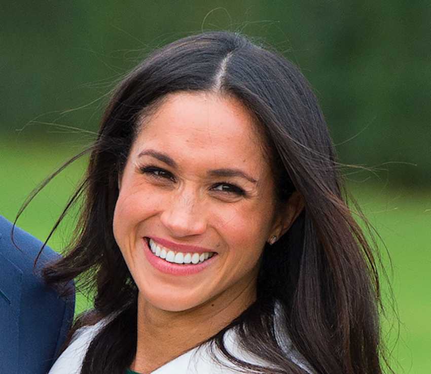 Meghan Markle Teeth