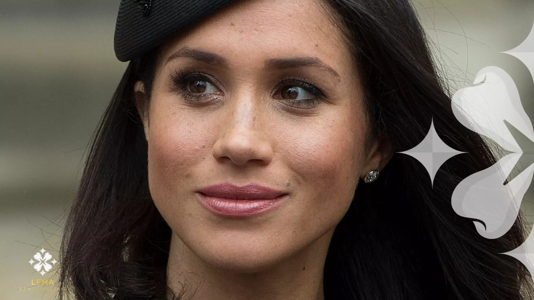 La Transformation Du Sourire De Megan Markle: Le Secret De Son Look Confiance