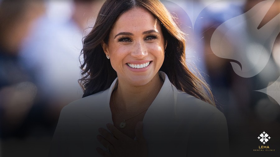 Meghan Markle's Smile Transformation