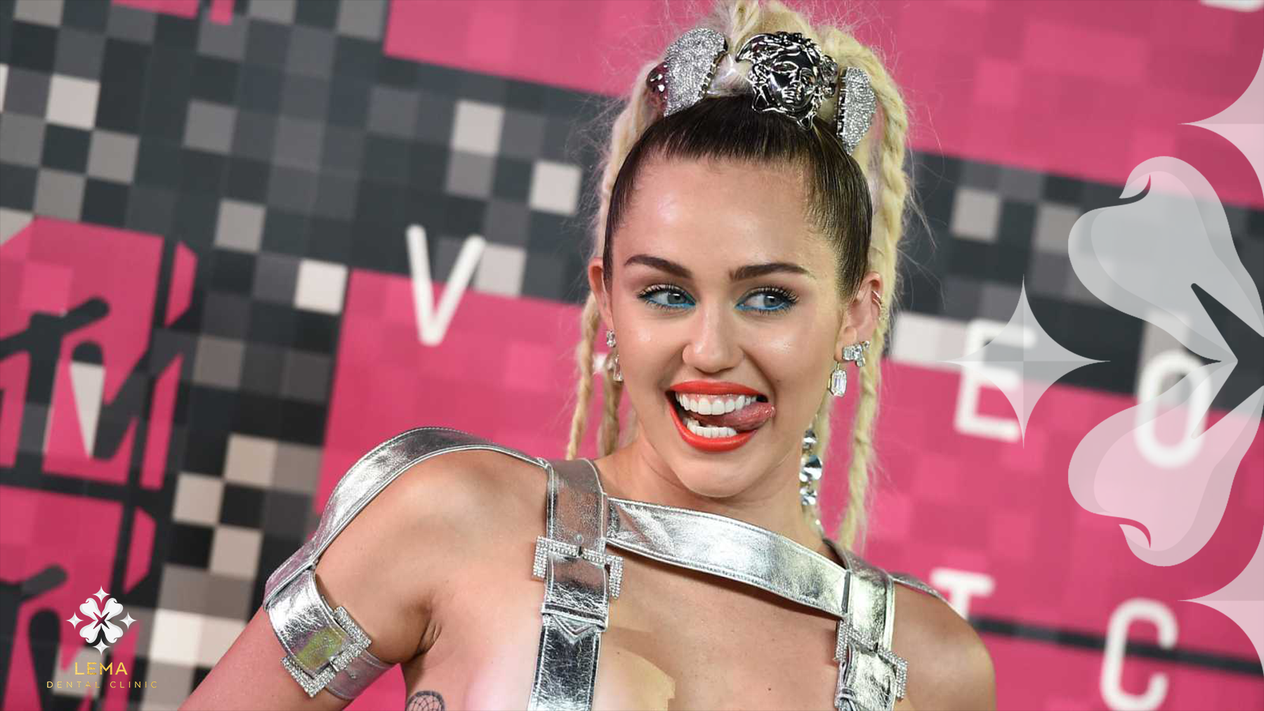 Les Dents De Miley Cyrus: Avant Et Après