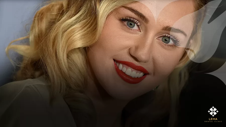 hollywood gülüşü