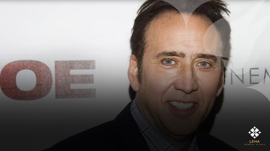 Nicolas Cage Dişleri