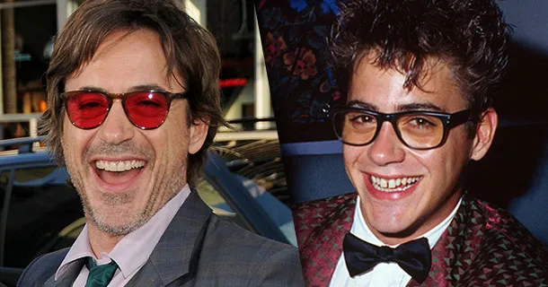 Robert Downey Jr. Gülüş Dönüşümü: Öncesi ve Sonrası