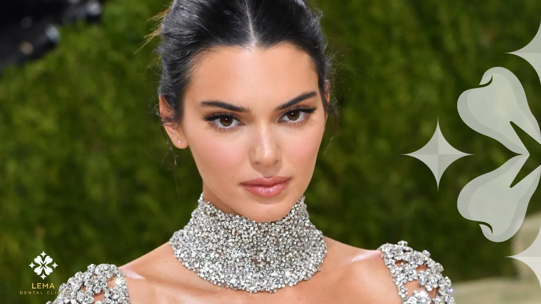 The Journey of Kendall Jenner's Smile Transformation