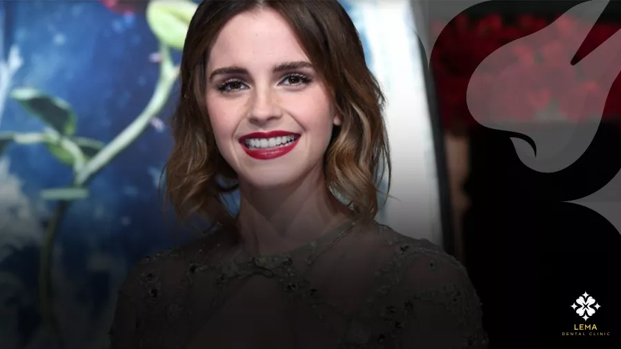 Emma Watson's Smile