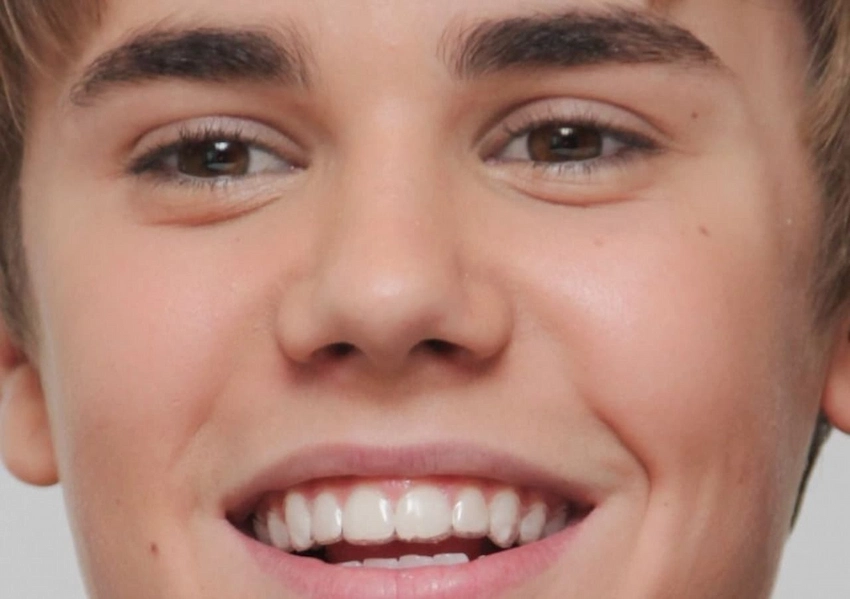Nouvelle dent de Justin Bieber