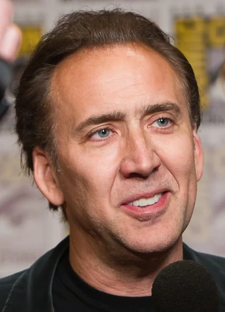 Nicolas cage teeth after