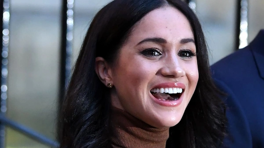 meghan markle după dinți