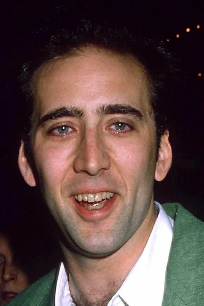 nicholas cage teeth before