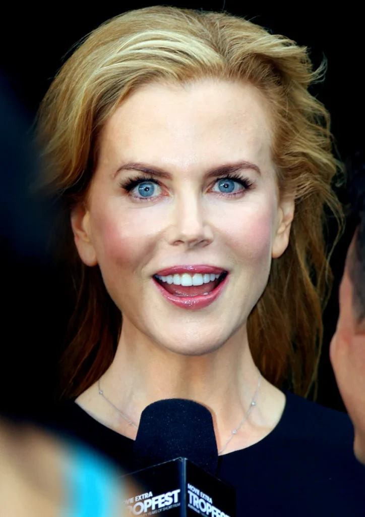 nicole kidman teeth
