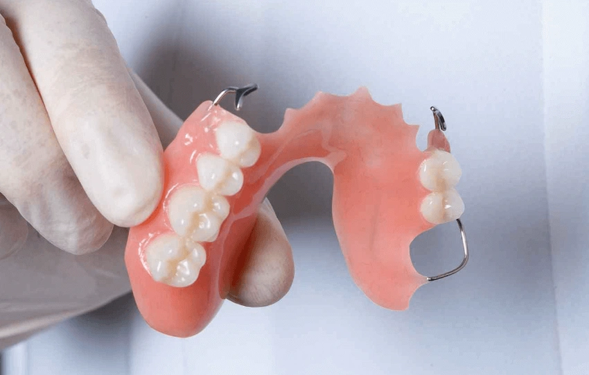 partial denture