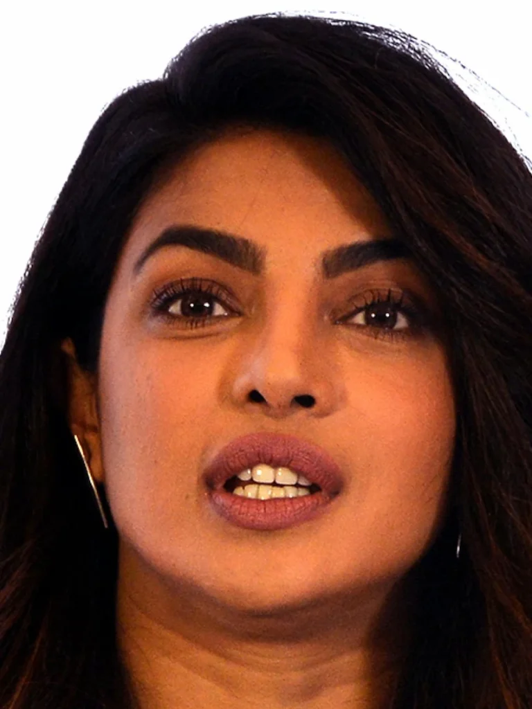 priyanka chopra teeth before