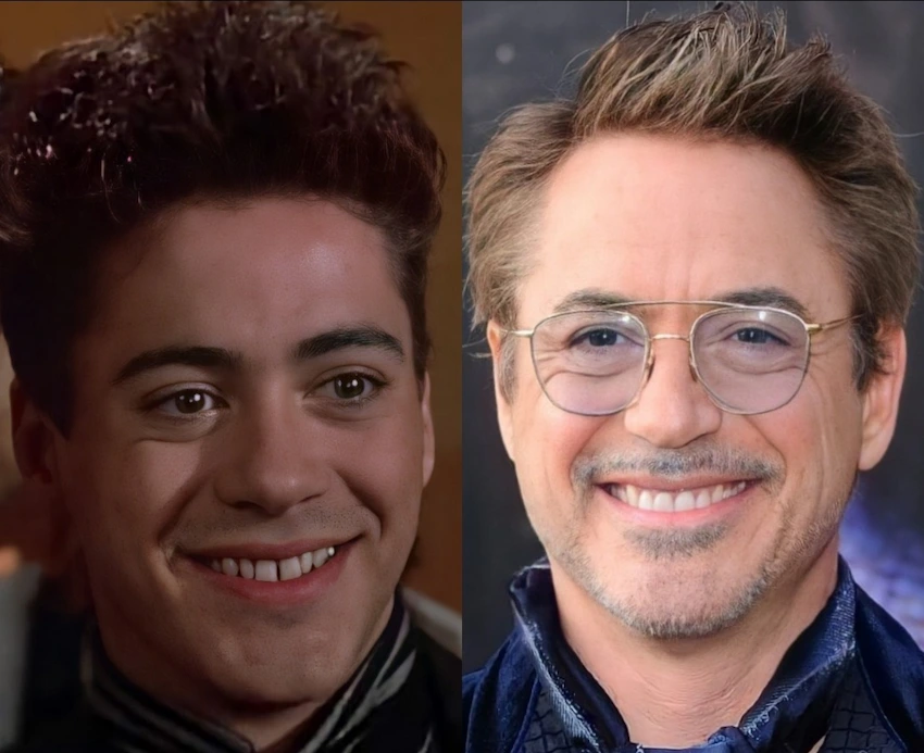 robert downey jr before after teeth