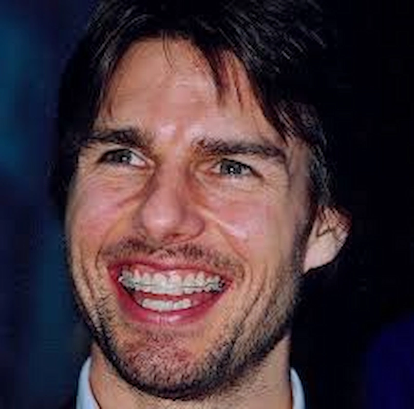 tom cruise treatment