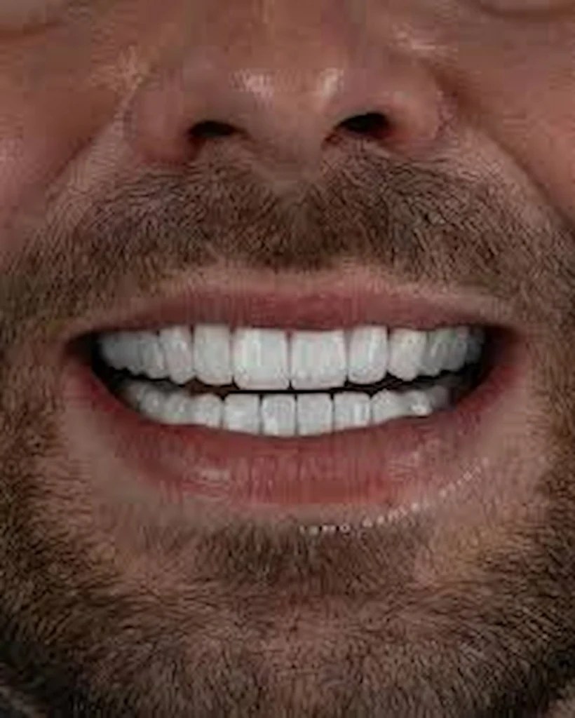 zirconium crown benefits