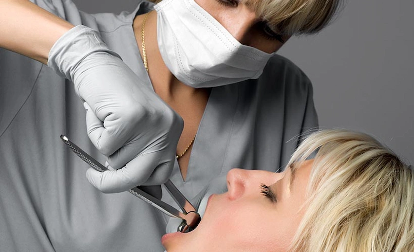 tooth extraction