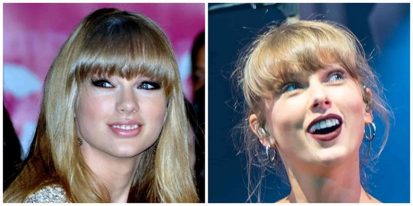Taylor swift gummy smile
