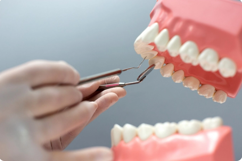 après extraction d'une dent