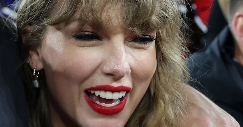 does taylor swift have veneers