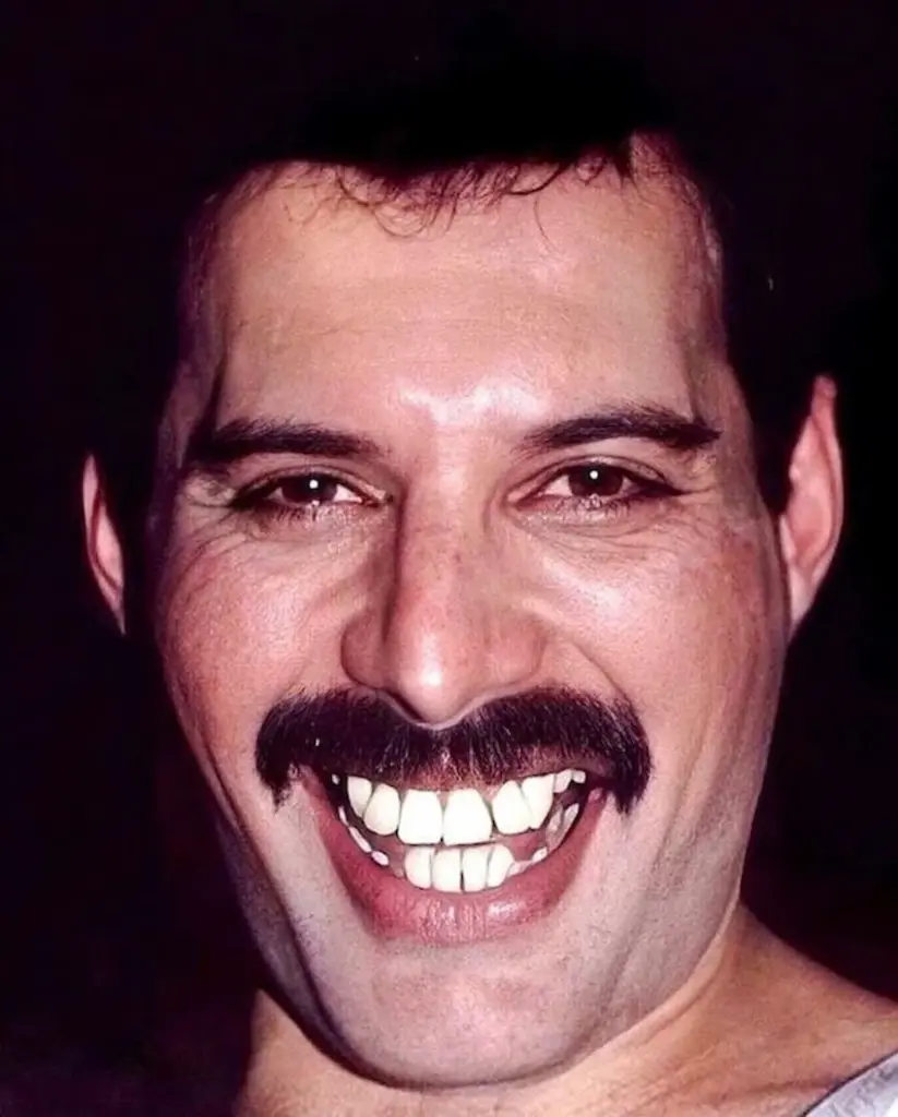 freddie mercurys teeth