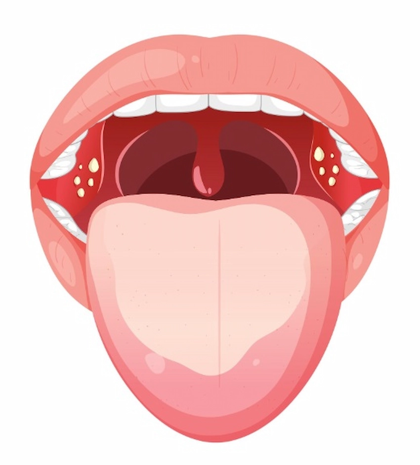 frenulum oral
